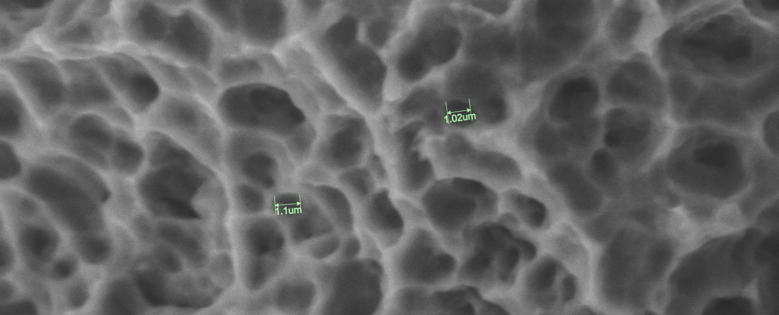 SuperSEM N10eX 在牙科种植体微观检测中的应用