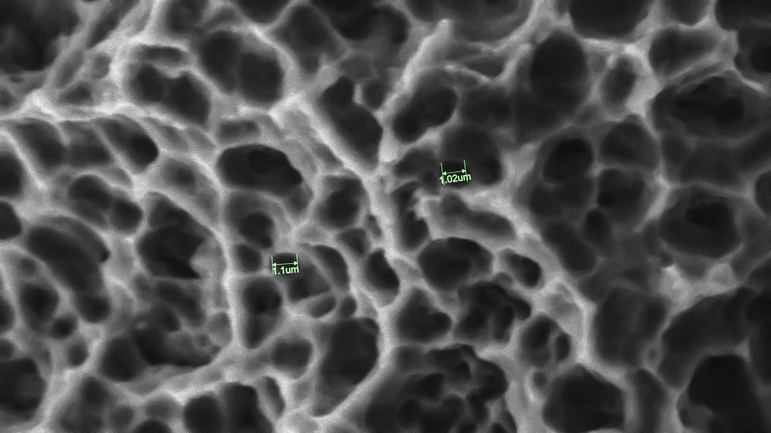 SuperSEM N10XL 在牙科种植体微观检测中的应用(图2)
